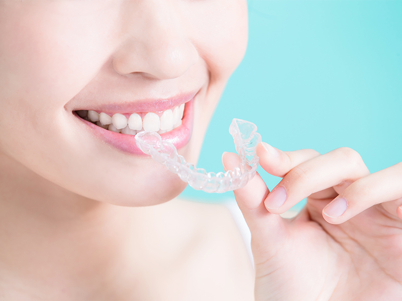 マウスピース矯正